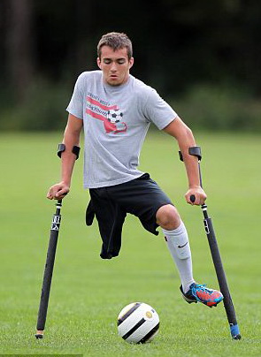 NICO CALABRIA, Pesepakbola Hebat dengan Satu Kaki